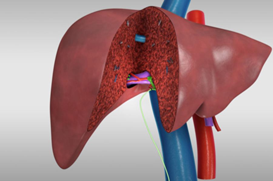 Skandāls nav atstāts nemanīts! Inspekcija veiks aknu transplantāciju auditu